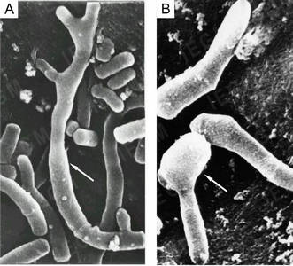 Scanning electron microscopy of R. ruber IEGM 333 cells grown on nutrient agar