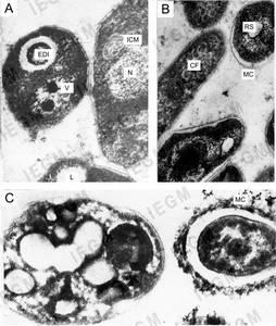 Ultra thin sections of R. ruber IEGM 333 (A, C) and IEGM 565 (B) grown on MSM in the presence of propane (A, B) or n-hexadecane (C)