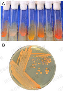 Growth of rhodococci on nutrient agar
