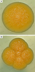 Individual colony (A) and a macrocolony of 5 CFUs (B) of R. ruber IEGM 342 on nutrient agar
