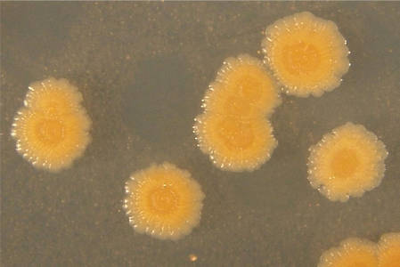 Colonies of R. ruber IEGM 236 on mineral salts agar with n-hexadecane